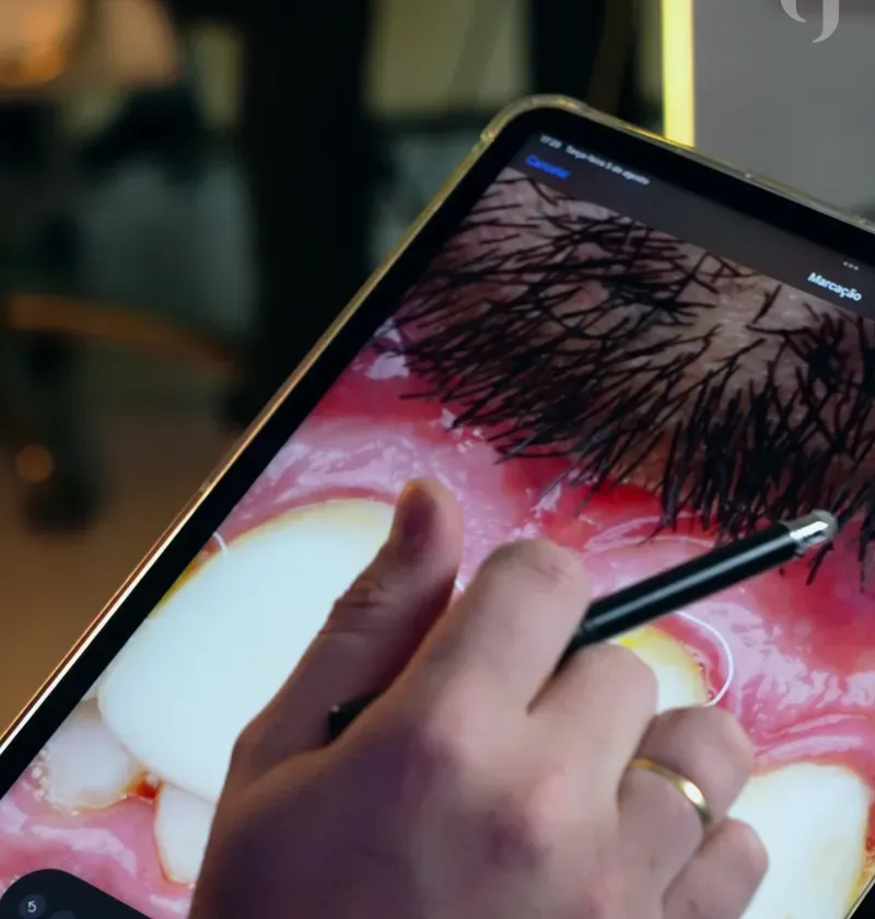 Profissional do Instituto realizando planejamento digital de um sorriso em um tablet
